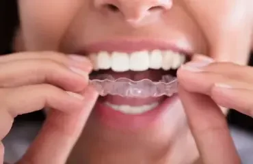 Bruxism Treatment